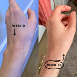 Permanent Hair Remover