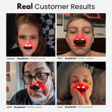 Red Light Nasal Therapy Instrument